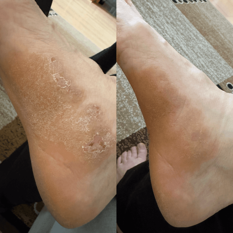 Crème pour peaux sèches, atopiques et sujettes à l'eczéma