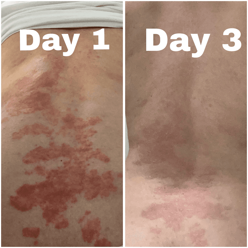 Crème pour peaux sèches, atopiques et sujettes à l'eczéma